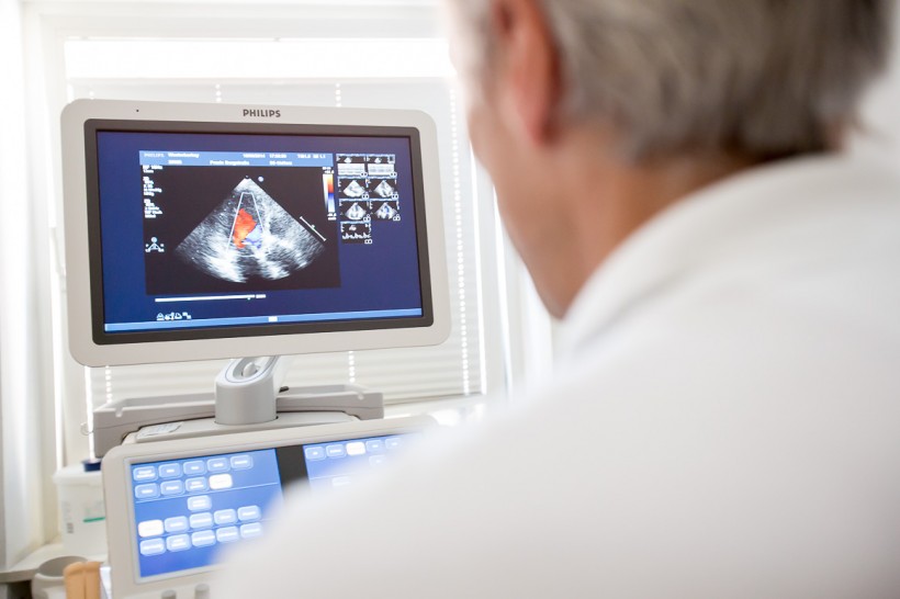 Color Doppler echocardiography