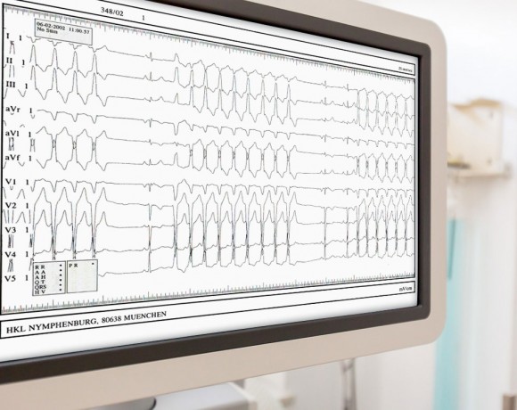 Elektrophysiologie / Katheterablation