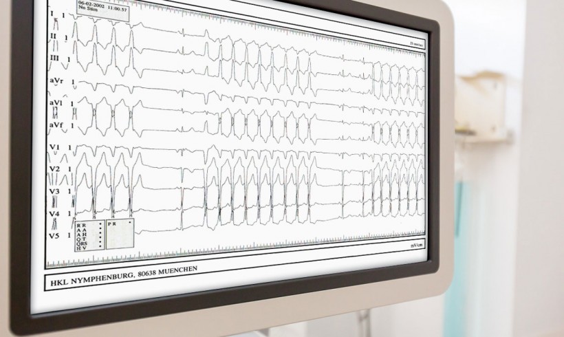 Electrophysiology / Catheter ablation