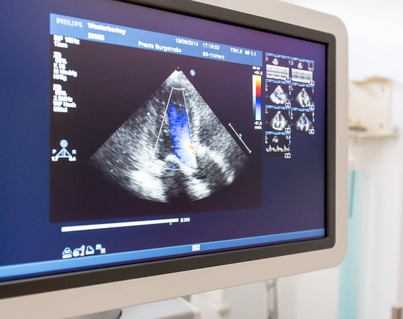 Transesophageal echocardiography (TEE)