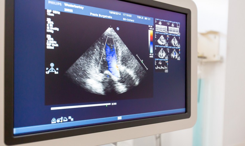 Transesophageal echocardiography (TEE)