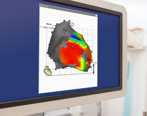 Elektrophysiologie / Katheterablation