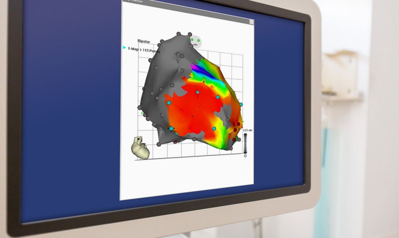 Elektrophysiologie / Katheterablation