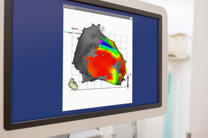 Electrophysiology / Catheter ablation